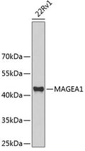 MAGEA1 polyclonal antibody - Figure 1 of 1