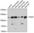 Western blot analysis of extracts of various cell lines, using NLRX1 antibody  at 1:3000 dilution.
Secondary antibody: HRP Goat Anti-Rabbit IgG   at 1:10000 dilution.
Lysates/proteins: 25ug per lane.
Blocking buffer: 3% nonfat dry milk in TBST.
Detection: ECL Basic Kit .
Exposure time: 10s.