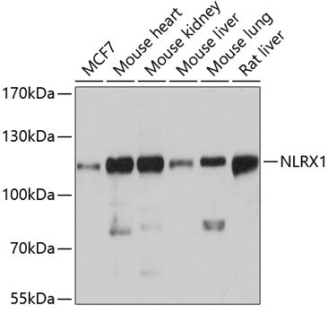 Western blot analysis of extracts of various cell lines, using NLRX1 antibody  at 1:3000 dilution.
Secondary antibody: HRP Goat Anti-Rabbit IgG   at 1:10000 dilution.
Lysates/proteins: 25ug per lane.
Blocking buffer: 3% nonfat dry milk in TBST.
Detection: ECL Basic Kit .
Exposure time: 10s.