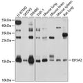 Western blot analysis of extracts of various cell lines, using EIF5A2 antibody  at 1:1000 dilution.
Secondary antibody: HRP Goat Anti-Rabbit IgG   at 1:10000 dilution.
Lysates/proteins: 25ug per lane.
Blocking buffer: 3% nonfat dry milk in TBST.
Detection: ECL Basic Kit .
Exposure time: 30s.