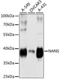 Western blot analysis of extracts of various cell lines, using NANS antibody  at 1:3000 dilution.
Secondary antibody: HRP Goat Anti-Rabbit IgG   at 1:10000 dilution.
Lysates/proteins: 25ug per lane.
Blocking buffer: 3% nonfat dry milk in TBST.
Detection: ECL Basic Kit .
Exposure time: 5s.