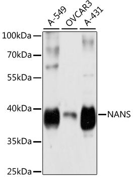 Western blot analysis of extracts of various cell lines, using NANS antibody  at 1:3000 dilution.
Secondary antibody: HRP Goat Anti-Rabbit IgG   at 1:10000 dilution.
Lysates/proteins: 25ug per lane.
Blocking buffer: 3% nonfat dry milk in TBST.
Detection: ECL Basic Kit .
Exposure time: 5s.