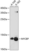 Western blot analysis of extracts of various cell lines, using MYCBP antibody  at 1:3000 dilution.
Secondary antibody: HRP Goat Anti-Rabbit IgG   at 1:10000 dilution.
Lysates/proteins: 25ug per lane.
Blocking buffer: 3% nonfat dry milk in TBST.
Detection: ECL Enhanced Kit .
Exposure time: 90s.
