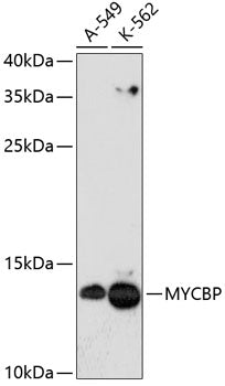 Western blot analysis of extracts of various cell lines, using MYCBP antibody  at 1:3000 dilution.
Secondary antibody: HRP Goat Anti-Rabbit IgG   at 1:10000 dilution.
Lysates/proteins: 25ug per lane.
Blocking buffer: 3% nonfat dry milk in TBST.
Detection: ECL Enhanced Kit .
Exposure time: 90s.