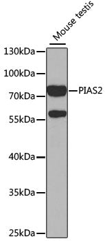 Western blot analysis of extracts of mouse testis, using PIAS2 antibody  at 1:1000 dilution.
Secondary antibody: HRP Goat…