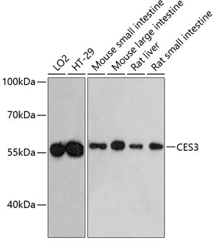 Western blot analysis of extracts of various cell lines, using CES3 antibody  at 1:3000 dilution.
Secondary antibody: HRP Goat Anti-Rabbit IgG   at 1:10000 dilution.
Lysates/proteins: 25ug per lane.
Blocking buffer: 3% nonfat dry milk in TBST.
Detection: ECL Enhanced Kit .
Exposure time: 60s.