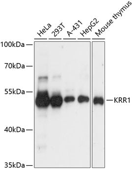 Western blot analysis of extracts of various cell lines, using KRR1 antibody  at 1:3000 dilution.
Secondary antibody: HRP Goat Anti-Rabbit IgG   at 1:10000 dilution.
Lysates/proteins: 25ug per lane.
Blocking buffer: 3% nonfat dry milk in TBST.
Detection: ECL Basic Kit .
Exposure time: 1s.