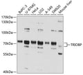 Western blot analysis of extracts of various cell lines, using TRIOBP antibody  at 1:1000 dilution.
Secondary antibody: HRP Goat Anti-Rabbit IgG   at 1:10000 dilution.
Lysates/proteins: 25ug per lane.
Blocking buffer: 3% nonfat dry milk in TBST.
Detection: ECL Basic Kit .
Exposure time: 15s.