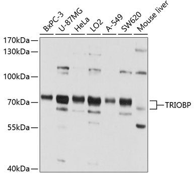 Western blot analysis of extracts of various cell lines, using TRIOBP antibody  at 1:1000 dilution.
Secondary antibody: HRP Goat Anti-Rabbit IgG   at 1:10000 dilution.
Lysates/proteins: 25ug per lane.
Blocking buffer: 3% nonfat dry milk in TBST.
Detection: ECL Basic Kit .
Exposure time: 15s.