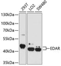 Western blot analysis of extracts of various cell lines, using EDAR antibody  at 1:1000 dilution.
Secondary antibody: HRP Goat Anti-Rabbit IgG   at 1:10000 dilution.
Lysates/proteins: 25ug per lane.
Blocking buffer: 3% nonfat dry milk in TBST.
Detection: ECL Basic Kit .
Exposure time: 90s.