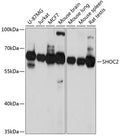 Western blot analysis of extracts of various cell lines, using SHOC2 Antibody  at 1:3000 dilution.
Secondary antibody: HRP Goat Anti-Rabbit IgG   at 1:10000 dilution.
Lysates/proteins: 25ug per lane.
Blocking buffer: 3% nonfat dry milk in TBST.
Detection: ECL Basic Kit .
Exposure time: 10s.