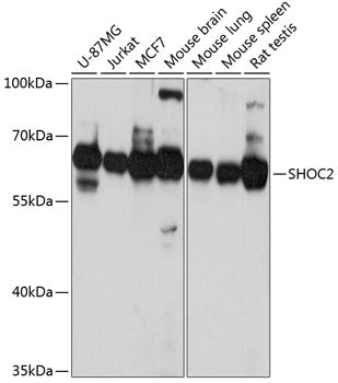 Western blot analysis of extracts of various cell lines, using SHOC2 Antibody  at 1:3000 dilution.
Secondary antibody: HRP Goat Anti-Rabbit IgG   at 1:10000 dilution.
Lysates/proteins: 25ug per lane.
Blocking buffer: 3% nonfat dry milk in TBST.
Detection: ECL Basic Kit .
Exposure time: 10s.