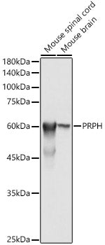 Western blot analysis of extracts of various cell lines, using PRPH  antibody  at 1:500 dilution.
Secondary antibody: HRP Goat Anti-Rabbit IgG   at 1:10000 dilution.
Lysates/proteins: 25ug per lane.
Blocking buffer: 3% nonfat dry milk in TBST.
Detection: ECL Basic Kit .
Exposure time: 1s.