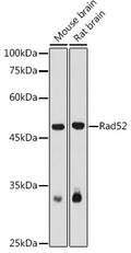 Western blot analysis of extracts of various cell lines, using Rad52 antibody  at 1:1000 dilution.
Secondary antibody: HRP Goat Anti-Rabbit IgG   at 1:10000 dilution.
Lysates/proteins: 25ug per lane.
Blocking buffer: 3% nonfat dry milk in TBST.
Detection: ECL Basic Kit .
Exposure time: 180s.