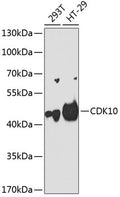 Western blot analysis of extracts of various cell lines, using CDK10 antibody  at 1:1000 dilution.
Secondary antibody: HRP Goat Anti-Rabbit IgG   at 1:10000 dilution.
Lysates/proteins: 25ug per lane.
Blocking buffer: 3% nonfat dry milk in TBST.
Detection: ECL Basic Kit .
Exposure time: 90s.