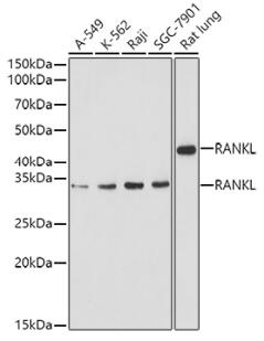 Western blot analysis of extracts of various cell lines, using RANKL antibody at 1:1000 dilution.