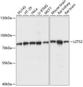 Western blot analysis of extracts of various cell lines, using LZTS2 antibody  at 1:1000 dilution.
Secondary antibody: HRP Goat Anti-Rabbit IgG   at 1:10000 dilution.
Lysates/proteins: 25ug per lane.
Blocking buffer: 3% nonfat dry milk in TBST.
Detection: ECL Basic Kit .
Exposure time: 5s.