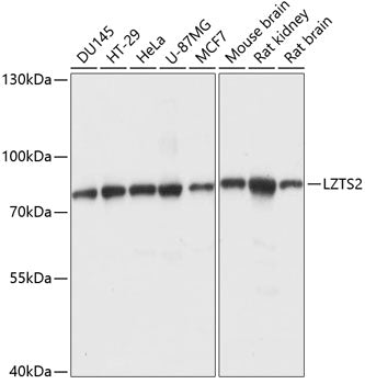 Western blot analysis of extracts of various cell lines, using LZTS2 antibody  at 1:1000 dilution.
Secondary antibody: HRP Goat Anti-Rabbit IgG   at 1:10000 dilution.
Lysates/proteins: 25ug per lane.
Blocking buffer: 3% nonfat dry milk in TBST.
Detection: ECL Basic Kit .
Exposure time: 5s.