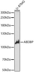 Western blot analysis of extracts of U-87MG cells, using ABI3BP antibody  at 1:1000 dilution.
Secondary antibody: HRP Goat Anti-Rabbit IgG   at 1:10000 dilution.
Lysates/proteins: 25ug per lane.
Blocking buffer: 3% nonfat dry milk in TBST.
Detection: ECL Basic Kit .
Exposure time: 20s.