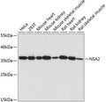 Western blot analysis of extracts of various cell lines, using NSA2 antibody  at 1:1000 dilution.
Secondary antibody: HRP Goat Anti-Rabbit IgG   at 1:10000 dilution.
Lysates/proteins: 25ug per lane.
Blocking buffer: 3% nonfat dry milk in TBST.
Detection: ECL Basic Kit .
Exposure time: 60s.
