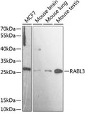 Western blot analysis of extracts of various cell lines, using RABL3 antibody  at 1:3000 dilution.
Secondary antibody: HRP Goat Anti-Rabbit IgG   at 1:10000 dilution.
Lysates/proteins: 25ug per lane.
Blocking buffer: 3% nonfat dry milk in TBST.
Detection: ECL Basic Kit .
Exposure time: 90s.