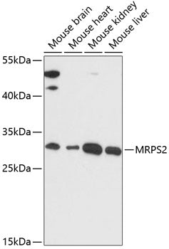 Western blot analysis of extracts of various cell lines, using MRPS2 antibody  at 1:3000 dilution.
Secondary antibody: HRP Goat Anti-Rabbit IgG   at 1:10000 dilution.
Lysates/proteins: 25ug per lane.
Blocking buffer: 3% nonfat dry milk in TBST.
Detection: ECL Basic Kit .
Exposure time: 90s.