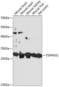 Western blot analysis of extracts of various cell lines, using TSPAN31 antibody  at 1:3000 dilution.
Secondary antibody: HRP Goat Anti-Rabbit IgG   at 1:10000 dilution.
Lysates/proteins: 25ug per lane.
Blocking buffer: 3% nonfat dry milk in TBST.
Detection: ECL Basic Kit .
Exposure time: 60s.