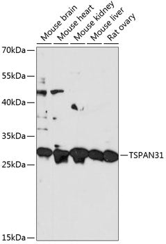 Western blot analysis of extracts of various cell lines, using TSPAN31 antibody  at 1:3000 dilution.
Secondary antibody: HRP Goat Anti-Rabbit IgG   at 1:10000 dilution.
Lysates/proteins: 25ug per lane.
Blocking buffer: 3% nonfat dry milk in TBST.
Detection: ECL Basic Kit .
Exposure time: 60s.