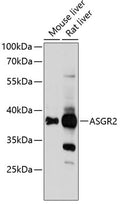 Western blot analysis of extracts of various cell lines, using ASGR2 Antibody  at 1:1000 dilution.
Secondary antibody: HRP Goat Anti-Rabbit IgG   at 1:10000 dilution.
Lysates/proteins: 25ug per lane.
Blocking buffer: 3% nonfat dry milk in TBST.
Detection: ECL Basic Kit .
Exposure time: 5s.