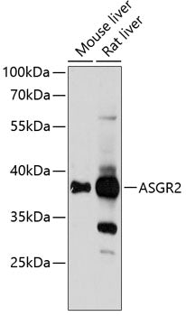 Western blot analysis of extracts of various cell lines, using ASGR2 Antibody  at 1:1000 dilution.
Secondary antibody: HRP Goat Anti-Rabbit IgG   at 1:10000 dilution.
Lysates/proteins: 25ug per lane.
Blocking buffer: 3% nonfat dry milk in TBST.
Detection: ECL Basic Kit .
Exposure time: 5s.