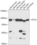 Western blot analysis of extracts of various cell lines, using CPT1C antibody  at 1:3000 dilution.
Secondary antibody: HRP Goat Anti-Rabbit IgG   at 1:10000 dilution.
Lysates/proteins: 25ug per lane.
Blocking buffer: 3% nonfat dry milk in TBST.
Detection: ECL Basic Kit .
Exposure time: 30s.