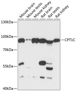 Western blot analysis of extracts of various cell lines, using CPT1C antibody  at 1:3000 dilution.
Secondary antibody: HRP Goat Anti-Rabbit IgG   at 1:10000 dilution.
Lysates/proteins: 25ug per lane.
Blocking buffer: 3% nonfat dry milk in TBST.
Detection: ECL Basic Kit .
Exposure time: 30s.