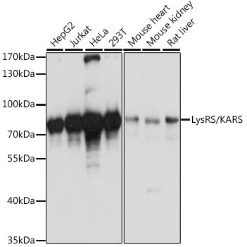 LysRS/KARS polyclonal antibody - Figure 1 of 1
