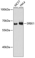 Western blot analysis of extracts of various cell lines, using SREK1 antibody  at 1:3000 dilution.
Secondary antibody: HRP Goat Anti-Rabbit IgG   at 1:10000 dilution.
Lysates/proteins: 25ug per lane.
Blocking buffer: 3% nonfat dry milk in TBST.
Detection: ECL Basic Kit .
Exposure time: 90s.