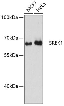 Western blot analysis of extracts of various cell lines, using SREK1 antibody  at 1:3000 dilution.
Secondary antibody: HRP Goat Anti-Rabbit IgG   at 1:10000 dilution.
Lysates/proteins: 25ug per lane.
Blocking buffer: 3% nonfat dry milk in TBST.
Detection: ECL Basic Kit .
Exposure time: 90s.