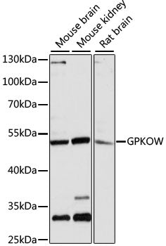 Western blot analysis of extracts of various cell lines, using GPKOW antibody  at 1:3000 dilution.
Secondary antibody: HRP Goat Anti-Rabbit IgG   at 1:10000 dilution.
Lysates/proteins: 25ug per lane.
Blocking buffer: 3% nonfat dry milk in TBST.
Detection: ECL Enhanced Kit .
Exposure time: 5s.