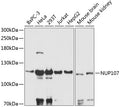 Western blot analysis of extracts of various cell lines, using NUP107 antibody  at 1:3000 dilution.
Secondary antibody: HRP Goat Anti-Rabbit IgG   at 1:10000 dilution.
Lysates/proteins: 25ug per lane.
Blocking buffer: 3% nonfat dry milk in TBST.
Detection: ECL Basic Kit .
Exposure time: 30s.