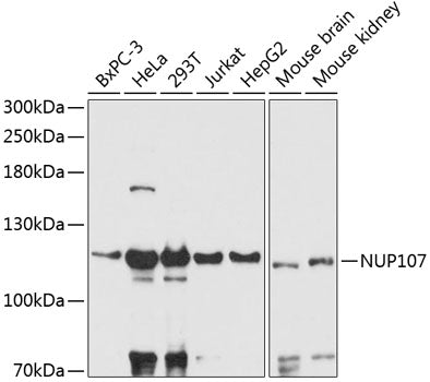Western blot analysis of extracts of various cell lines, using NUP107 antibody  at 1:3000 dilution.
Secondary antibody: HRP Goat Anti-Rabbit IgG   at 1:10000 dilution.
Lysates/proteins: 25ug per lane.
Blocking buffer: 3% nonfat dry milk in TBST.
Detection: ECL Basic Kit .
Exposure time: 30s.