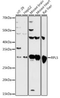Western blot analysis of extracts of various cell lines, using RPL5 antibody  at 1:500 dilution.
Secondary antibody: HRP Goat Anti-Rabbit IgG   at 1:10000 dilution.
Lysates/proteins: 25ug per lane.
Blocking buffer: 3% nonfat dry milk in TBST.
Detection: ECL Basic Kit .
Exposure time: 60s.