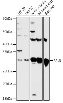 Western blot analysis of extracts of various cell lines, using RPL5 antibody  at 1:500 dilution.
Secondary antibody: HRP Goat Anti-Rabbit IgG   at 1:10000 dilution.
Lysates/proteins: 25ug per lane.
Blocking buffer: 3% nonfat dry milk in TBST.
Detection: ECL Basic Kit .
Exposure time: 60s.