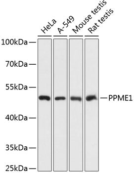 Western blot analysis of extracts of various cell lines, using PPME1 antibody  at 1:3000 dilution.
Secondary antibody: HRP Goat Anti-Rabbit IgG   at 1:10000 dilution.
Lysates/proteins: 25ug per lane.
Blocking buffer: 3% nonfat dry milk in TBST.
Detection: ECL Basic Kit .
Exposure time: 1s.