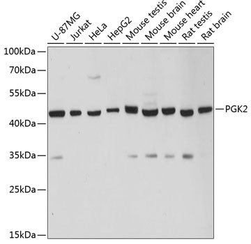 Western blot analysis of extracts of various cell lines, using PGK2 antibody  at 1:3000 dilution.
Secondary antibody: HRP Goat Anti-Rabbit IgG   at 1:10000 dilution.
Lysates/proteins: 25ug per lane.
Blocking buffer: 3% nonfat dry milk in TBST.
Detection: ECL Basic Kit .
Exposure time: 5s.