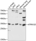 Western blot analysis of extracts of various cell lines, using ATP6V1D antibody  at 1:3000 dilution.
Secondary antibody: HRP Goat Anti-Rabbit IgG   at 1:10000 dilution.
Lysates/proteins: 25ug per lane.
Blocking buffer: 3% nonfat dry milk in TBST.
Detection: ECL Basic Kit .
Exposure time: 60s.