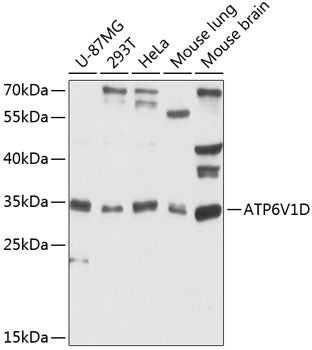 Western blot analysis of extracts of various cell lines, using ATP6V1D antibody  at 1:3000 dilution.
Secondary antibody: HRP Goat Anti-Rabbit IgG   at 1:10000 dilution.
Lysates/proteins: 25ug per lane.
Blocking buffer: 3% nonfat dry milk in TBST.
Detection: ECL Basic Kit .
Exposure time: 60s.