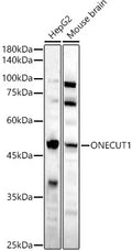 Western blot analysis of various lysates, using ONECUT1 antibody  at 1:1600 dilution.
Secondary antibody: HRP Goat Anti-Rabbit IgG   at 1:10000 dilution.
Lysates/proteins: 25ug per lane.
Blocking buffer: 3% nonfat dry milk in TBST.
Detection: ECL Basic Kit .
Exposure time: 180s.