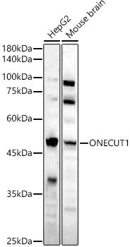 Western blot analysis of various lysates, using ONECUT1 antibody  at 1:1600 dilution.
Secondary antibody: HRP Goat Anti-Rabbit IgG   at 1:10000 dilution.
Lysates/proteins: 25ug per lane.
Blocking buffer: 3% nonfat dry milk in TBST.
Detection: ECL Basic Kit .
Exposure time: 180s.