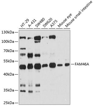Western blot analysis of extracts of various cell lines, using FAM46A antibody  at 1:3000 dilution._Secondary antibody: HRP Goat Anti-Rabbit IgG   at 1:10000 dilution._Lysates/proteins: 25ug per lane._Blocking buffer: 3% nonfat dry milk in TBST._Detection: ECL Enhanced Kit ._Exposure time: 90s.