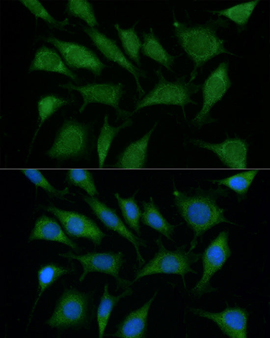 Immunofluorescence analysis of L929 using TRIM45 antibody  at dilution of  1:100 . Blue: DAPI for nuclear staining.