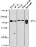 Western blot analysis of extracts of various cell lines, using IFT74 antibody  at 1:3000 dilution.
Secondary antibody: HRP Goat Anti-Rabbit IgG   at 1:10000 dilution.
Lysates/proteins: 25ug per lane.
Blocking buffer: 3% nonfat dry milk in TBST.
Detection: ECL Basic Kit .
Exposure time: 90s.
