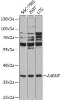 Western blot analysis of extracts of various cell lines, using A4GNT antibody  at 1:1000 dilution.
Secondary antibody: HRP Goat Anti-Rabbit IgG   at 1:10000 dilution.
Lysates/proteins: 25ug per lane.
Blocking buffer: 3% nonfat dry milk in TBST.
Detection: ECL Basic Kit .
Exposure time: 90s.